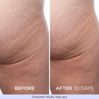 NeoLift Pro™ Firming Cream