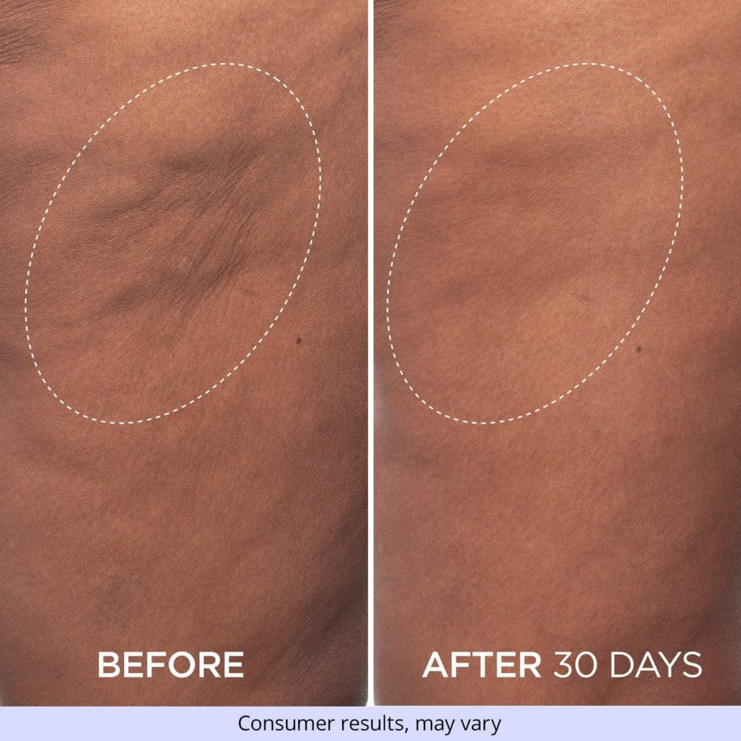 NeoLift Pro™ Firming Cream