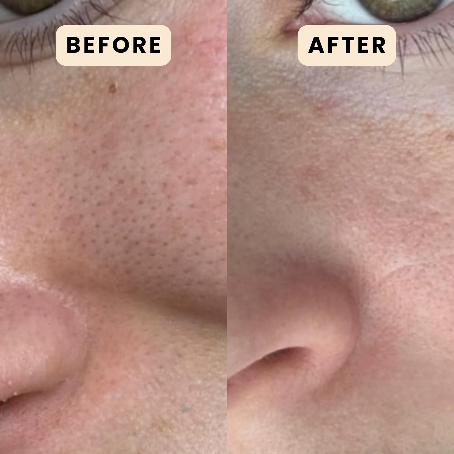 Lunia® Rice Exfoliating Ampoule